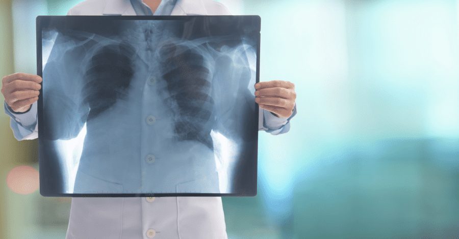Aposentadoria do técnico em radiologia: quais as regras deste benefício?
